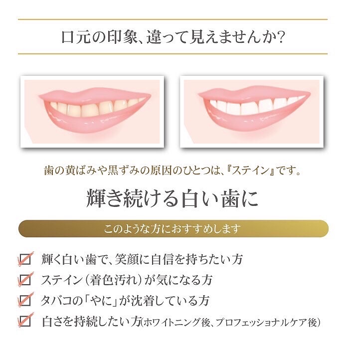 セルフホワイトニングで実感❗ セルフホワイトニングで実感❗