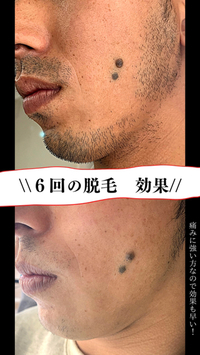 なぜ男性は痛みに弱いのか？