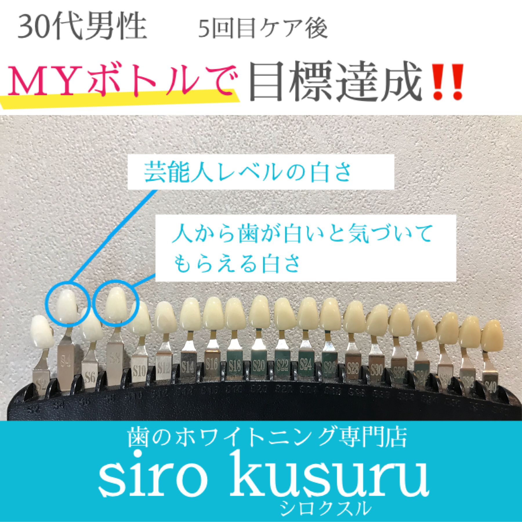 奄美初 歯のホワイトニング専門店 Siro Kusuru シロクスル おススメ Myボトル